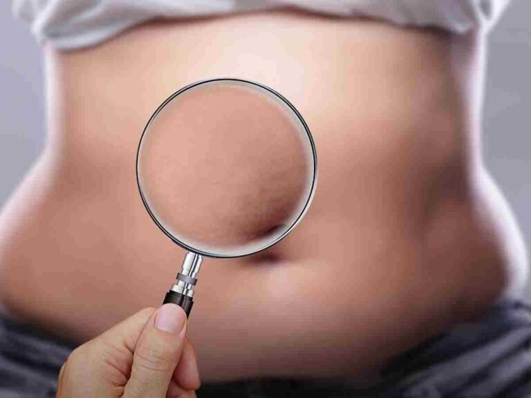 الدكتور محمد الحربي يتحدث عن الفئات الممنوعة من عملية تكميم المعدة