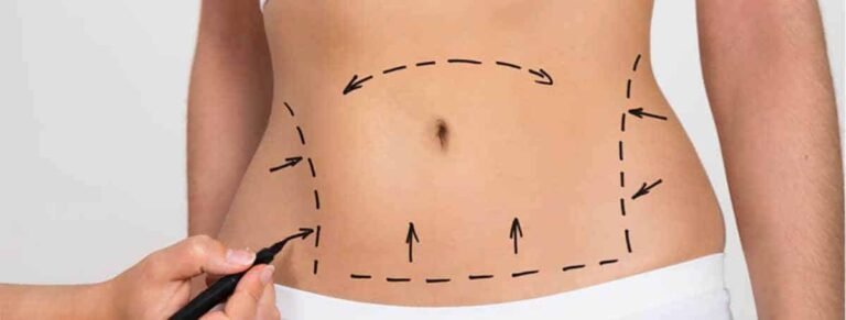 أفضل بدائل عملية تكميم المعدة: رؤية الدكتور محمد الحربي بالرياض لعلاج السمنة بأمان وفعالية