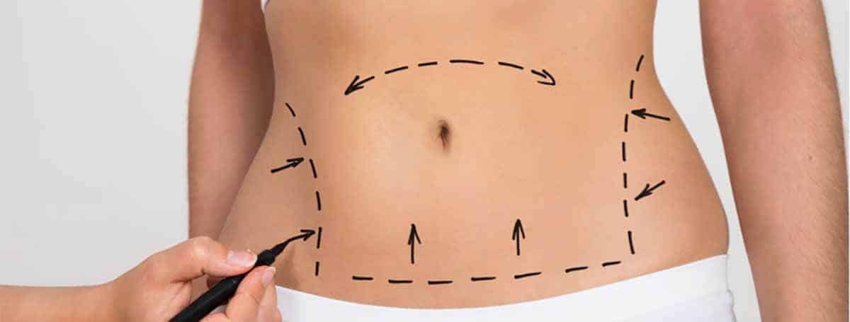 أفضل بدائل عملية تكميم المعدة: رؤية الدكتور محمد الحربي بالرياض لعلاج السمنة بأمان وفعالية