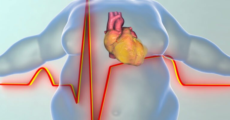 مخاطر السمنة على القلب والشرايين وطرق الوقاية الحديثة مع الدكتور محمد الحربي في الرياض