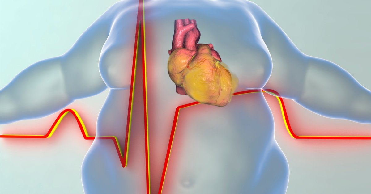 مخاطر السمنة على القلب والشرايين وطرق الوقاية الحديثة مع الدكتور محمد الحربي في الرياض